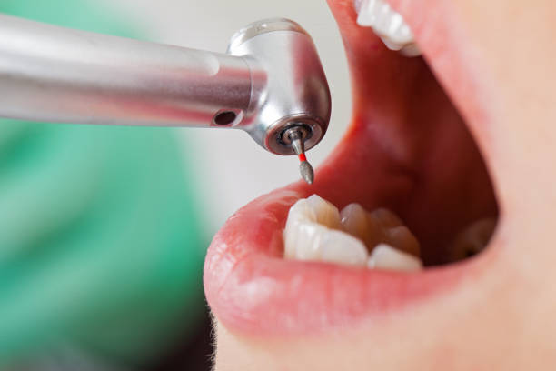 Best Emergency Root Canal Treatment in Gateway, AK